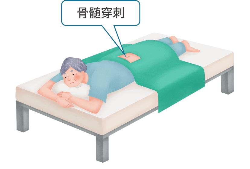 骨髄穿刺をうけている多発性骨髄腫患者さん